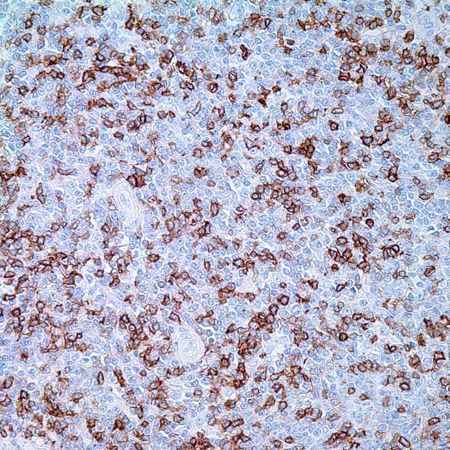 CD5 (4C7) Mouse Monoclonal Antibody - Image 1