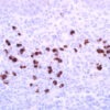IgG4 (EP138) Rabbit Monoclonal Antibody