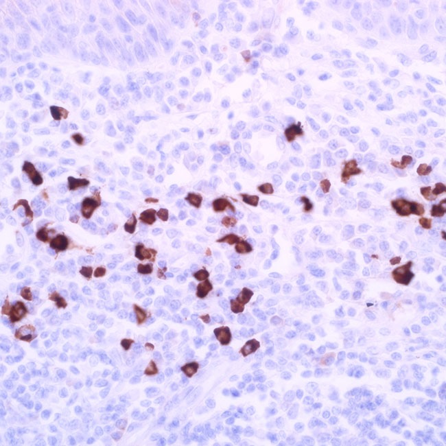 IgG4 (EP138) Rabbit Monoclonal Antibody